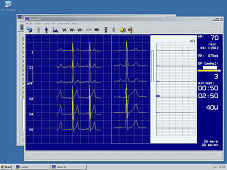 EKG Cardiax PC v rozpisu příslušenství